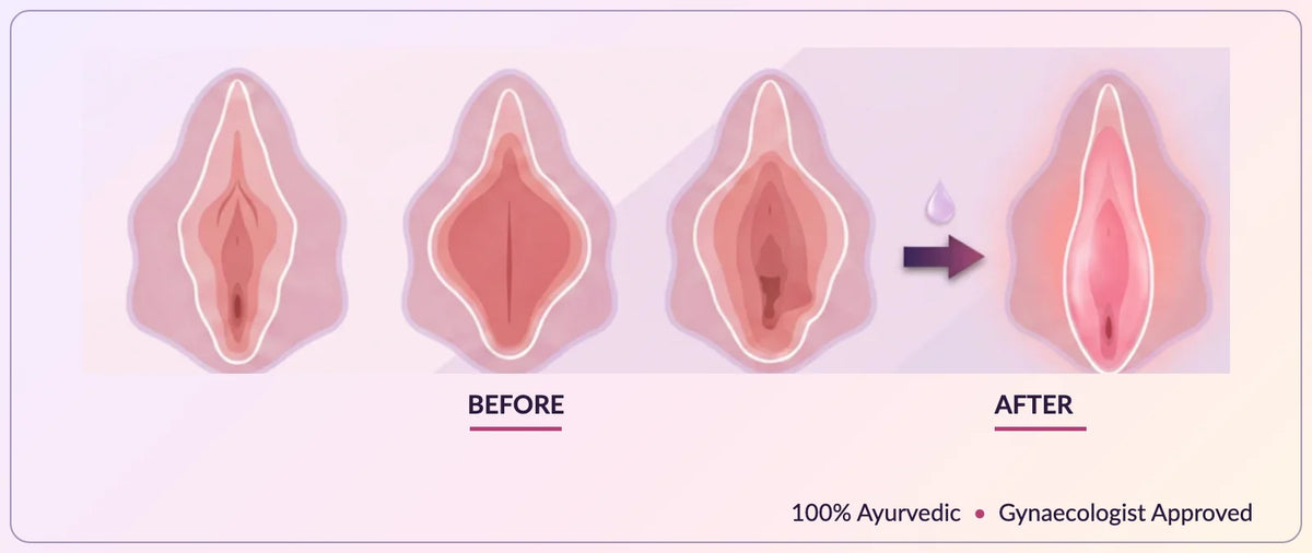 Corian Intimate V-Tightening Care Ayurvedic Serum